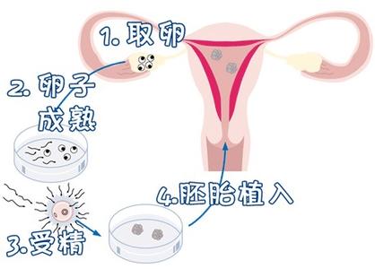 42岁高龄成功案例